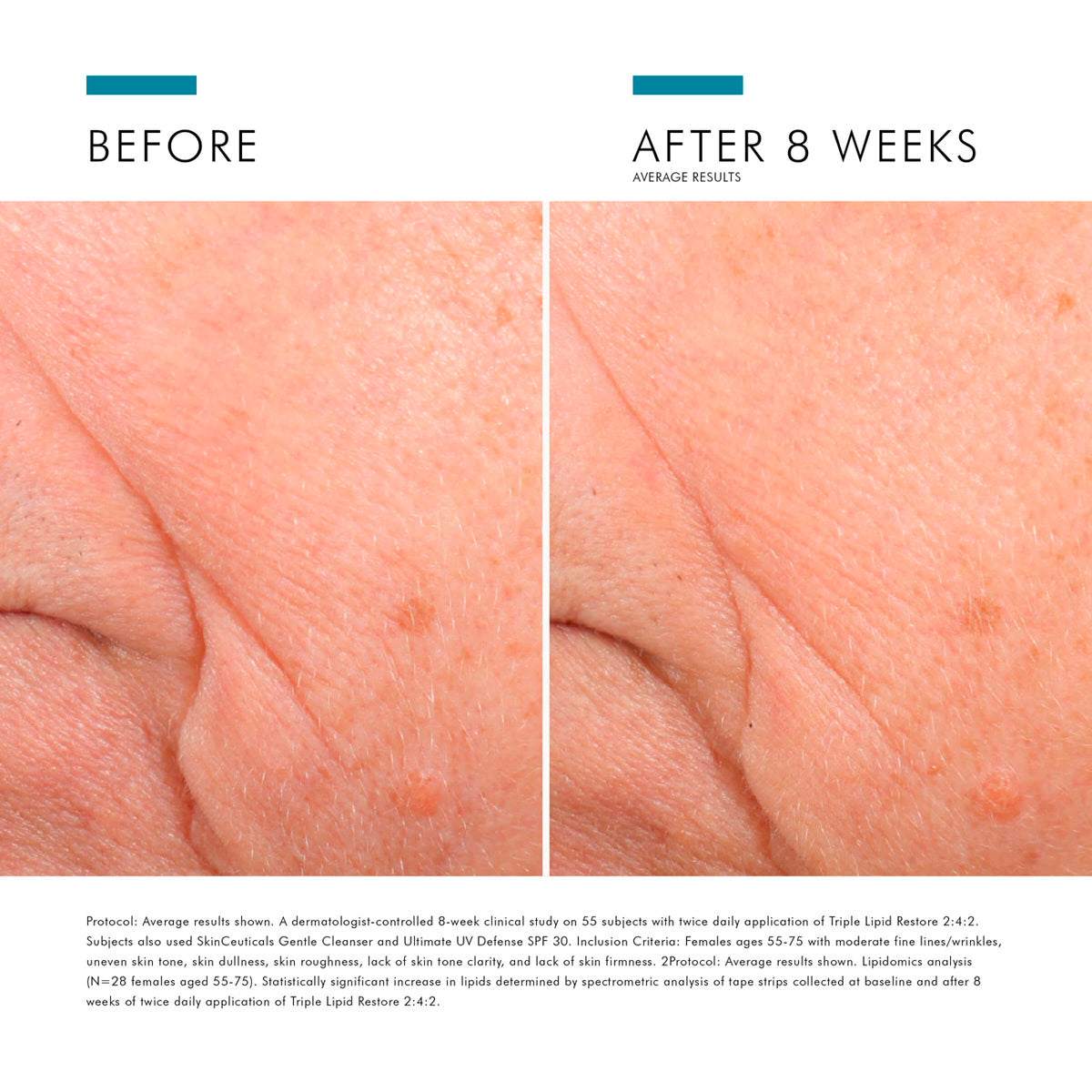 Triple Lipid Restore