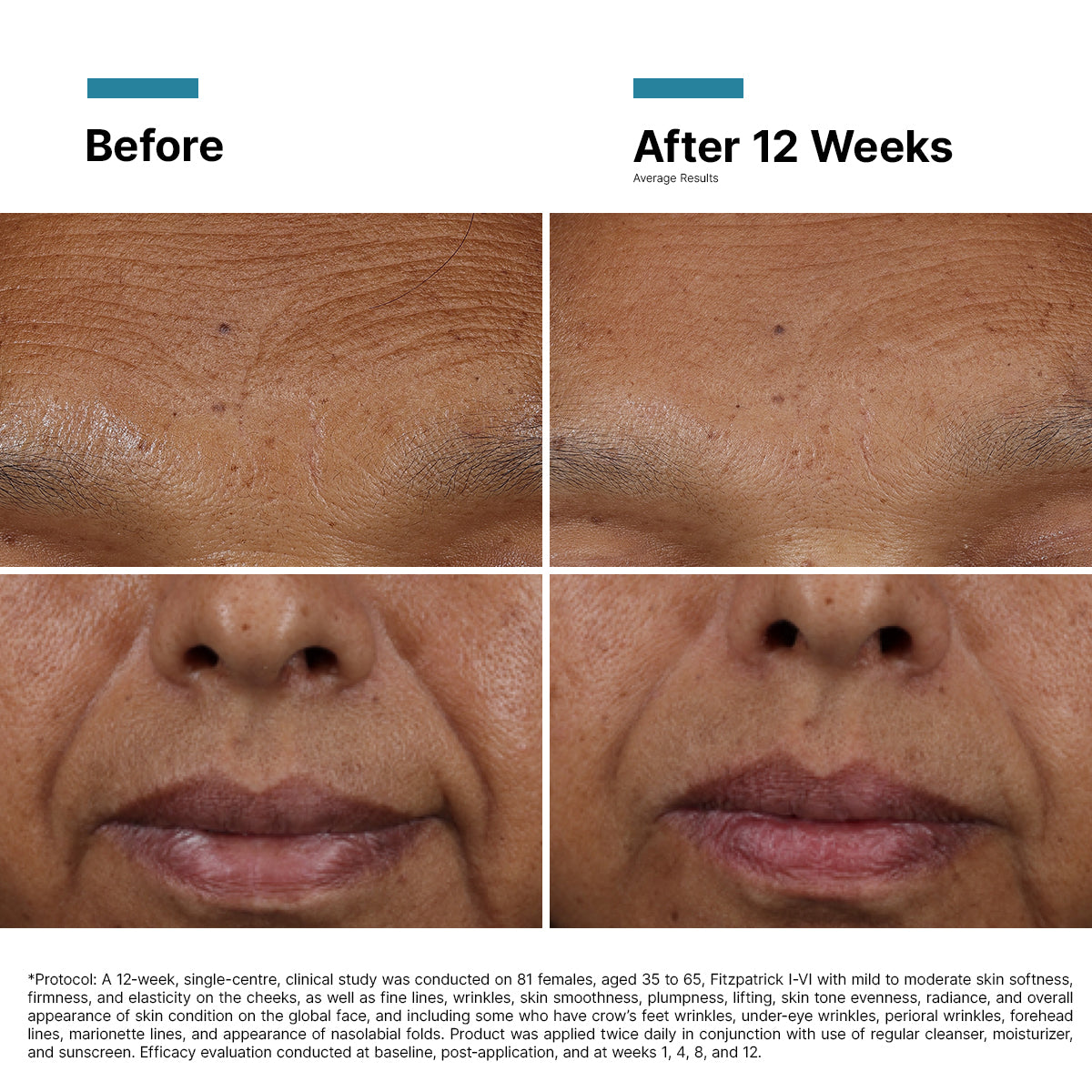 SkinCeuticals H.A Intensifier Multi-Glycan