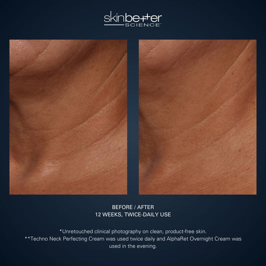 Techno Neck Perfecting Cream