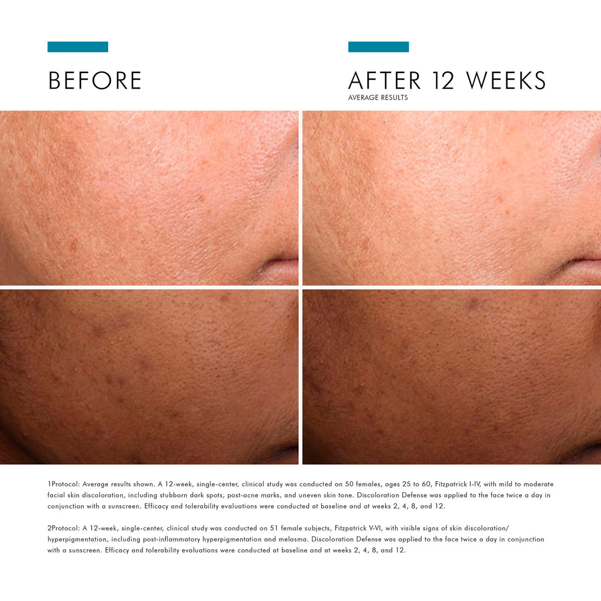 SkinCeuticals Discoloration Defence®