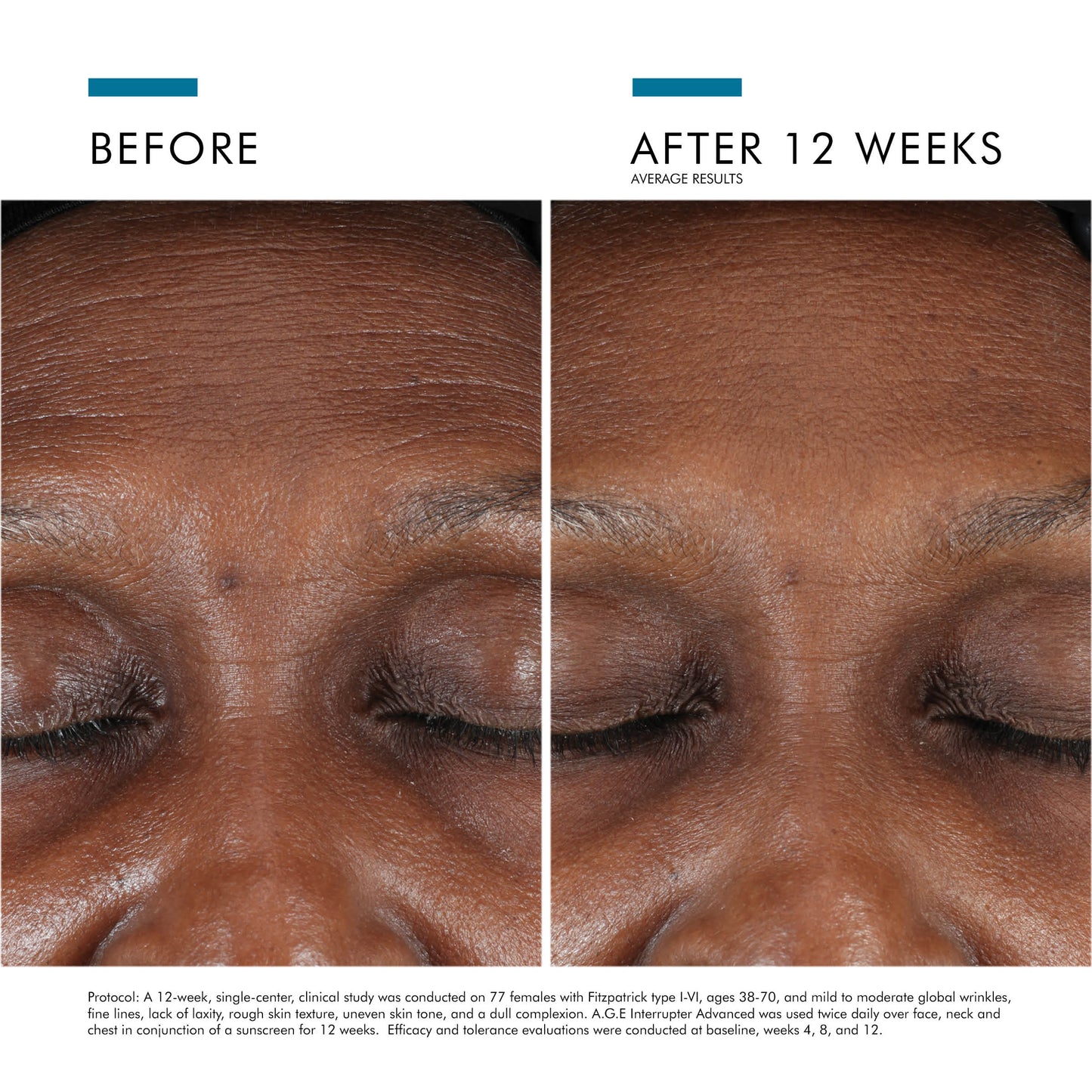 SkinCeuticals A.G.E. Interrupter Advanced